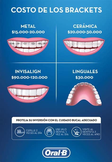 cuanto cuestan los brackets metalicos en españa|donde ponen brackets gratis.